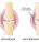 Does Glucosamine Chondroitin Help knee and Joint Pain Due to Osteoarthritis?