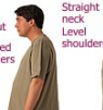 Exercises  To Correct Forward Head and Shoulder Posture