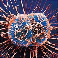 breast cancer cell