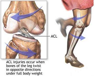FREE ACL injury prevention gym...